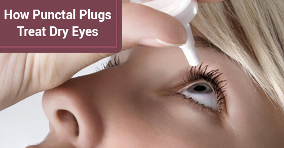 How Punctal Plugs Treat Dry Eyes