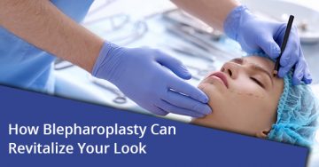 How Blepharoplasty Can Revitalize Your Look
